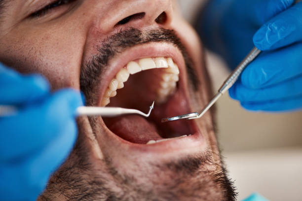 Best Preventive Dentistry  in Lakeland North, WA